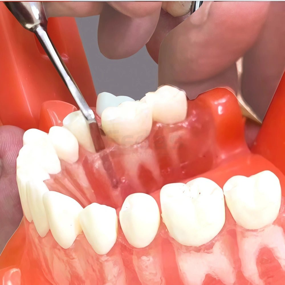 Gingival Retraction Set - EEDAS Dental