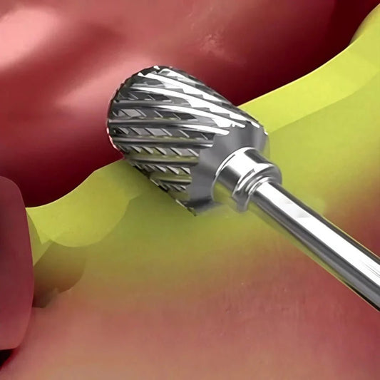 What Are Pineapple Burs Used For in Implant Surgery? - EEDAS Dental
