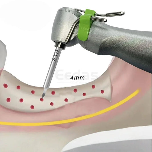 What is a GBR bone graft? - EEDAS Dental