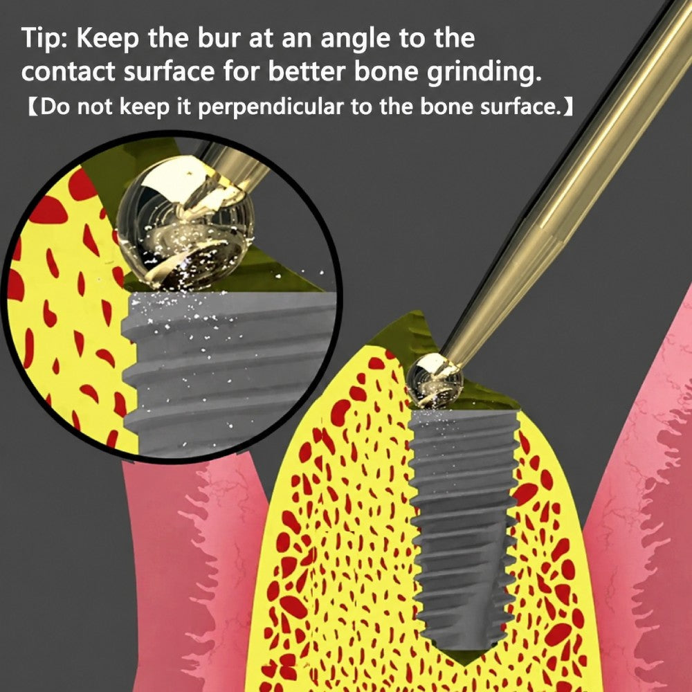 Implant Bone Contouring Round ball Bur