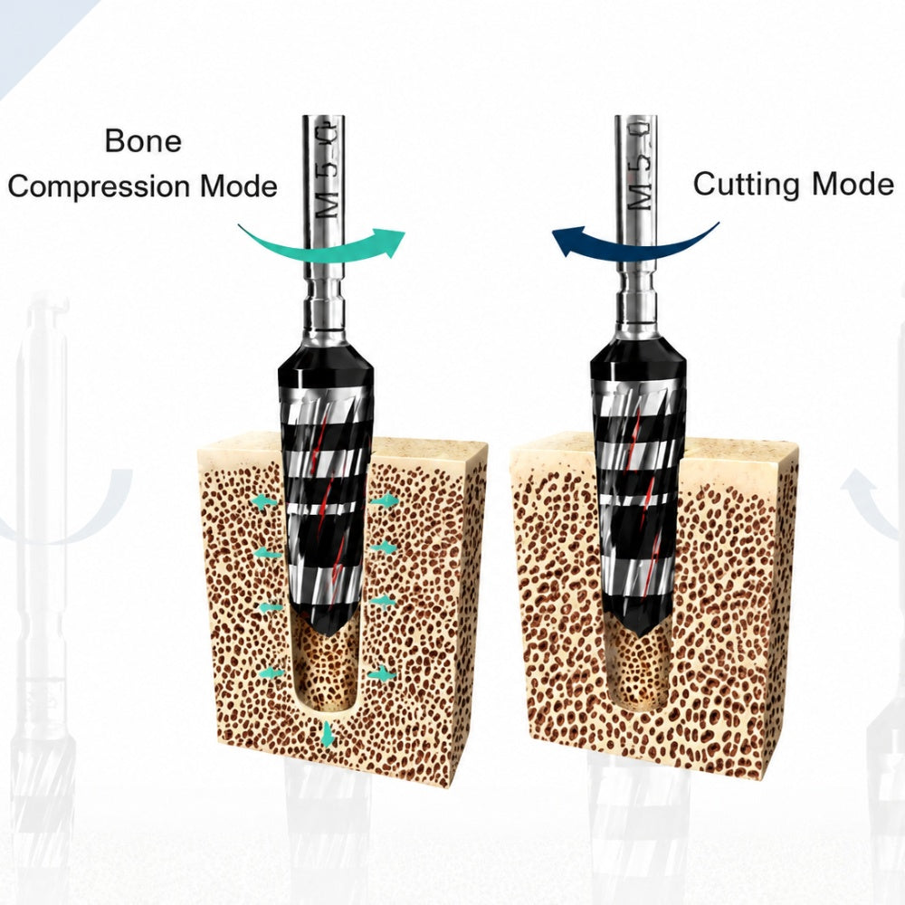 Osseodensification Bur