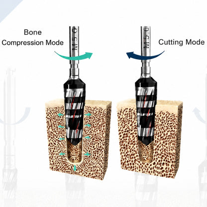 Osseodensification Bur
