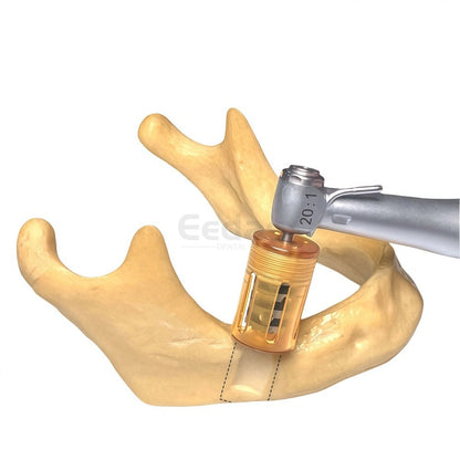 Dental Half Moon Bone Chip Trephine Drill - EEDAS Dental