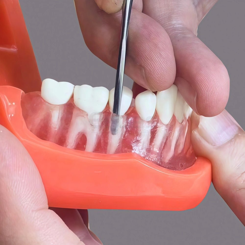 Gingival Retraction Set - EEDAS Dental