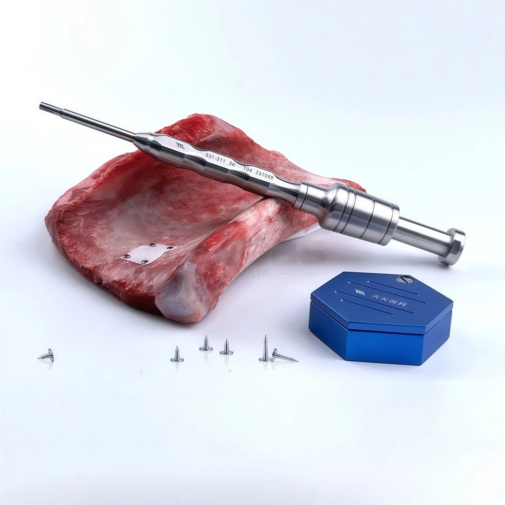 Spring - Loaded Bone Tack Kit - EEDAS Dental